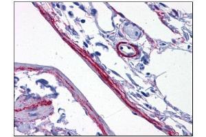 Human Perivascular Processes: Formalin-Fixed, Paraffin-Embedded (FFPE) (SYNPO antibody  (C-Term))