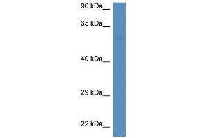 Western Blot showing DUOXA1 antibody used at a concentration of 1 ug/ml against Jurkat Cell Lysate (DUOXA1 antibody  (C-Term))