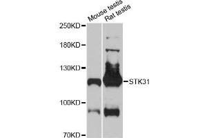 Western blot analysis of extracts of various cell lines, using STK31 antibody (ABIN6293705) at 1:3000 dilution. (STK31 antibody)