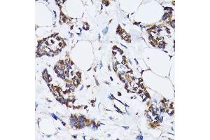 Immunohistochemistry (Paraffin-embedded Sections) (IHC (p)) image for anti-Tumor Protein P53 (TP53) (AA 1-100) antibody (ABIN6149405)