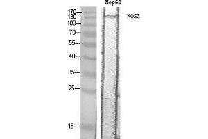 Western Blot (WB) analysis of HepG2 cells using NOS3 Polyclonal Antibody. (ENOS antibody  (Thr180))