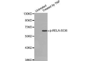 Western blot analysis of extracts from HepG2 cells using Phospho-RELA-S536 antibody. (NF-kB p65 antibody  (pSer536))