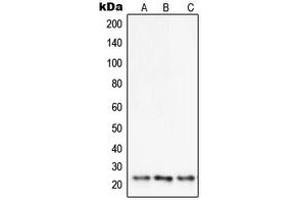 Western blot analysis of SENP8 expression in Raji (A), HeLa (B), Caki1 (C) whole cell lysates.