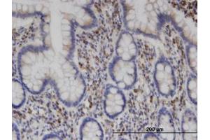 Image no. 2 for anti-Clathrin Interactor 1 (CLINT1) (AA 161-262) antibody (ABIN599495) (CLINT1 antibody  (AA 161-262))