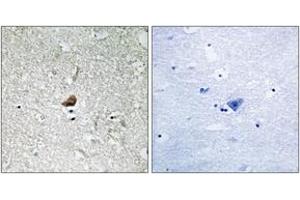 Immunohistochemistry analysis of paraffin-embedded human brain, using IRAK1 (Ab-376) Antibody. (IRAK1 antibody  (AA 342-391))