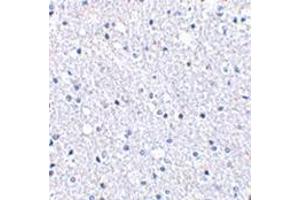 Immunohistochemistry of TIGAR in human brain tissue with this product at 2. (TIGAR antibody  (Center))