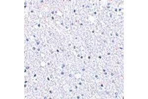 Immunohistochemistry of TIGAR in human brain tissue with this product at 2. (TIGAR antibody  (Center))