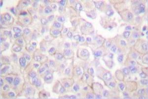 Image no. 1 for anti-Claudin 2 (CLDN2) antibody (ABIN265361) (Claudin 2 antibody)