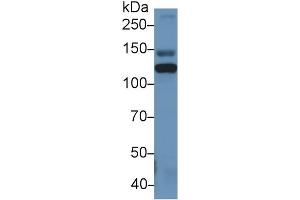 Western Blot; Sample: Rat Serum; Primary Ab: 1µg/ml Rabbit Anti-Human ITIH4 Antibody Second Ab: 0. (ITIH4 antibody  (AA 273-424))