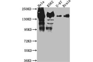 Western Blot Positive WB detected in: Hela whole cell lysate, K562 whole cell lysate, U-87 whole cell lysate, Mouse Brain whole cell lysate All lanes: SF3B1 antibody at 1:1000 Secondary Goat polyclonal to rabbit IgG at 1/50000 dilution Predicted band size: 146, 17 kDa Observed band size: 130 kDa (Recombinant SF3B1 antibody)