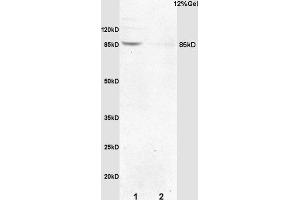 Formalin-fixed and paraffin embedded mouse embryo labeled with Anti-p95 NBS1/Cell cycle regulatory protein p95 Polyclonal Antibody, Unconjugated (ABIN762776) at 1:200 followed by conjugation to the secondary antibody and DAB staining. (Nibrin antibody  (AA 641-754))