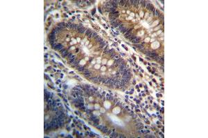 PG Antibody (Center) (ABIN657161 and ABIN2846295) immunohistochemistry analysis in formalin fixed and paraffin embedded human colon tissue followed by peroxidase conjugation of the secondary antibody and DAB staining. (PGAP3 antibody  (AA 141-169))