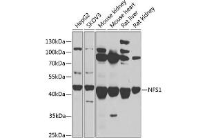 Western blot analysis of extracts of various cell lines, using NFS1 antibody (ABIN6130224, ABIN6144594, ABIN6144596 and ABIN6217361) at 1:1000 dilution. (NFS1 antibody  (AA 208-457))