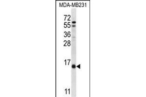 HINT3 Antibody (N-term) (ABIN657020 and ABIN2846199) western blot analysis in MDA-M cell line lysates (35 μg/lane).