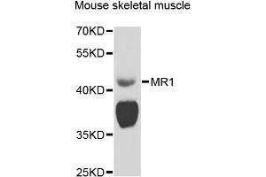 Western blot analysis of extracts of mouse skeletal muscle, using MR1 antibody (ABIN5974481) at 1/1000 dilution. (MR1 antibody)