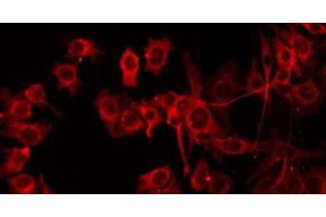 ABIN6279645 staining HepG2 by IF/ICC. (CROT antibody  (Internal Region))