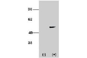 Western blot analysis of STK38L polyclonal antibody  transiently transfected HEK-293 cell line lysate (1 ug/lane). (STK38L antibody  (C-Term))