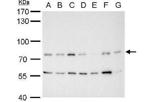 Western Blotting (WB) image for anti-Mdm2, p53 E3 Ubiquitin Protein Ligase Homolog (Mouse) (MDM2) (Center) antibody (ABIN2854782)