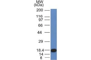 Western Blot Analysis of recombinant fragment of CD117 with CD117 Mouse Monoclonal Antibody (KIT/982). (KIT antibody  (AA 100-300))