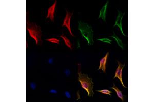 ABIN6262864 and ABIN6277023 staining Hela cells by IF/ICC. (KPNA4 antibody  (C-Term))