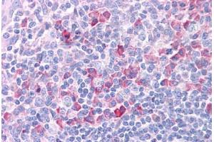Human Tonsil: Formalin-Fixed, Paraffin-Embedded (FFPE) (DLL1 antibody  (N-Term))