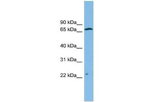 WB Suggested Anti-ZNF135 Antibody Titration: 0. (ZNF135 antibody  (N-Term))
