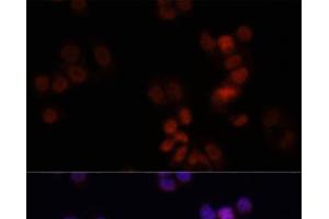 Immunofluorescence analysis of HCT116 cells using KDM7A Polyclonal Antibody at dilution of 1:150. (JHDM1D antibody)