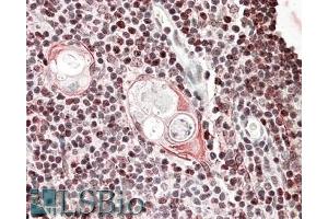 ABIN571004 (3. (SATB1 antibody  (Internal Region))