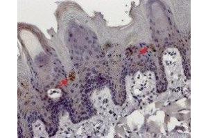 Expression of TRPM5 in rat tongue - Immunohistochemical staining of rat tongue paraffin embedded sections using Anti-TRPM5 Antibody (ABIN7043834, ABIN7044010 and ABIN7044011), (1:100). (TRPM5 antibody  (Intracellular))