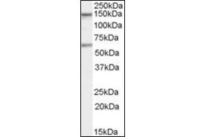 Antibody staining (1 µg/ml) of human Jurkat cells (RIPA buffer, 35 µg total protein per lane). (CARD11 antibody  (C-Term))