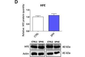 Iron export machinery-related hephaestin (HEPH) and the hemochromatosis gene (HFE) related to systemic iron loading are elevated at the mRNA level but not on the protein level in tumor-initiating cells (TICs)Expression of the HEPH gene at the mRNA level in breast non-malignant cell line MCF10A, in TICs derived from breast cancer cell lines MCF-7, BT-474, T-47D and ZR-75-30 as well as from prostate cancer cell lines DU-145 and LNCaP has been determined (A) together with protein levels in the MCF-7 cell line (CTRL) and MCF-7 derived spheres (SPH) (B). (HFE antibody  (AA 262-348))