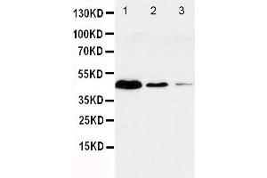 Anti-Caspase-1(P20) antibody, Western blotting Lane 1: JURKAT Cell Lysate Lane 2: RAJI Cell Lysate Lane 3: CEM Cell Lysate (Caspase 1 antibody  (N-Term))