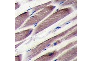 Immunohistochemistry (IHC) image for anti-LATS, Large Tumor Suppressor, Homolog 2 (Drosophila) (LATS2) (AA 228-258) antibody (ABIN3031595)