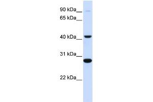 WB Suggested Anti-CYB561 Antibody Titration:  0.