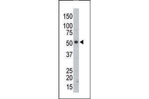 Image no. 2 for anti-Src-Related Kinase Lacking C-Terminal Regulatory Tyrosine and N-Terminal Myristylation Sites (SRMS) (C-Term) antibody (ABIN359994) (SRMS antibody  (C-Term))