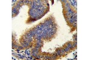 Cyclin B1 antibody immunohistochemistry analysis in formalin fixed and paraffin embedded human uterus tissue. (Cyclin B1 antibody  (AA 381-411))