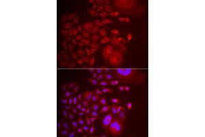 Immunofluorescence analysis of U2OS cell using TRAPPC10 antibody. (TRAPPC10 antibody)