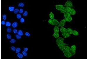 IF analysis of Ikaros using anti-Ikaros2 antibody (ABIN3043860). (IKZF1 antibody  (C-Term))