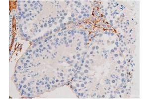 Immunohistochemistry (IHC) image for anti-Signal Transducer and Activator of Transcription 1, 91kDa (STAT1) (pSer727) antibody (ABIN6256410)