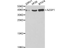 Western Blotting (WB) image for anti-alpha-2-Glycoprotein 1, Zinc-Binding (AZGP1) antibody (ABIN1876553) (AZGP1 antibody)