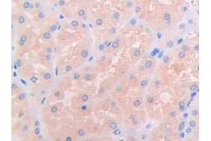 DAB staining on IHC-P; Samples: Human Kidney Tissue (IL3RA antibody  (AA 19-158))