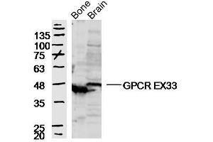 Mouse bone and brain lysates probed with GPCR EX33 Polyclonal Antibody, unconjugated  at 1:300 overnight at 4°C followed by a conjugated secondary antibody at 1:10000 for 90 minutes at 37°C. (GPR84 antibody  (AA 21-120))