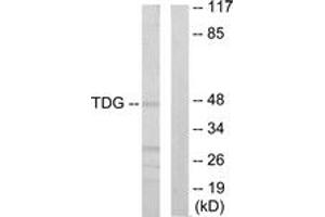 Western Blotting (WB) image for anti-Thymine-DNA Glycosylase (TDG) (AA 31-80) antibody (ABIN2889581) (TDG antibody  (AA 31-80))
