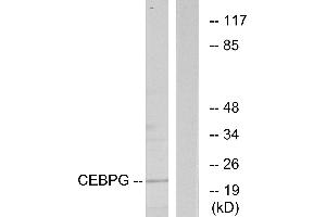 Immunohistochemistry analysis of paraffin-embedded human heart tissue using CEBPG antibody. (CEBPG antibody)