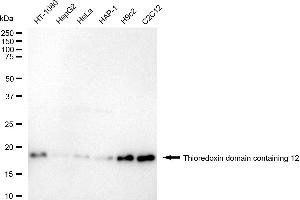 Western blotting analysis using thioredoxin domain containing 12 antibody (ABIN7800540).