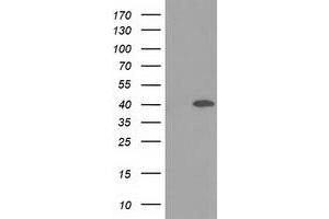 HEK293T cells were transfected with the pCMV6-ENTRY control (Left lane) or pCMV6-ENTRY DNAJB1 (Right lane) cDNA for 48 hrs and lysed. (DNAJB1 antibody)