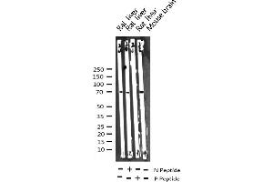 Western blot analysis of Phospho-p70 S6 Kinase (Thr421) expression in various lysates (RPS6KB1 antibody  (pThr421))