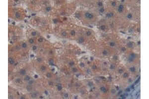 Immunohistochemistry (IHC) image for anti-Plexin B1 (PLXNB1) (AA 200-727) antibody (ABIN7438175)