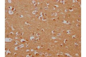 IHC image of ABIN7165095 diluted at 1:100 and staining in paraffin-embedded human brain tissue performed on a Leica BondTM system. (EIF2C3 antibody  (AA 251-400))
