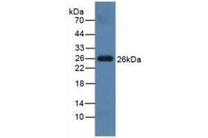 Detection of PRSS2 in Mouse Testis lysate using Polyclonal Antibody to Protease, Serine 2 (PRSS2) (PRSS2 antibody  (AA 29-240))